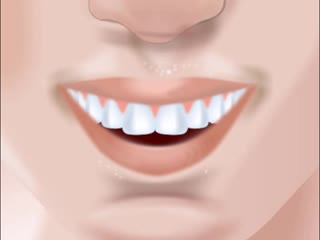 how to determine the correct color of teeth?