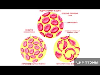 hemolytic anemia. how to treat hemolytic anemia.