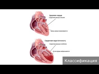 heart failure. how to treat heart failure.