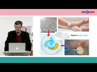 modern possibilities of wet therapy for chronic wounds