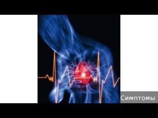 cardiogenic shock. how to treat cardiogenic shock.