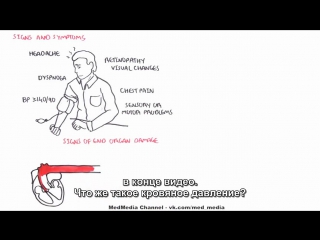 hypertension - overview