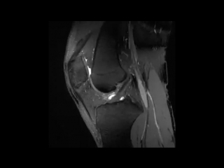 mri scans of the knee joint