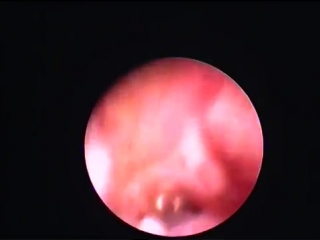 otoscopy of the external auditory canal.