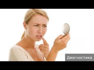 perioral dermatitis. how to treat perioral dermatitis.