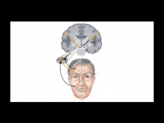 topical diagnosis of lesions of the facial nerve