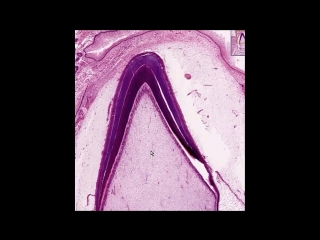 tooth development. stage of formation of tooth tissues (histogenesis)