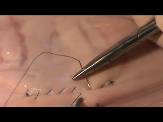 intestinal suture of lambert. docent a d. stepanov, pdatu