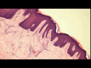 lip lips histological structure. norm