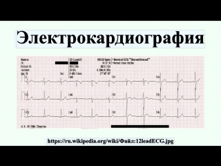 electrocardiography