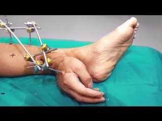 5 incredible surgical operations